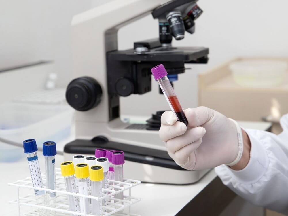 Testy na intoleranciu u mačiek